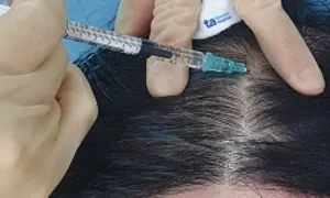 Tại sao rụng tóc sau phẫu thuật? Tại sao rụng tóc sau phẫu thuật?