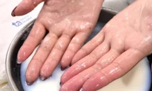 10 ngón tay cô gái bị bỏng ớt phồng rộp