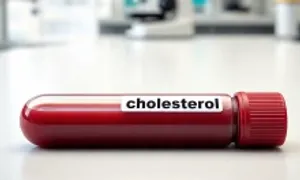 Cholesterol Cholesterol