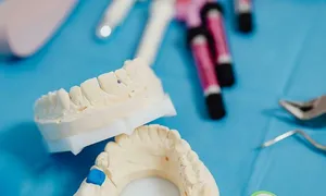 Tự mua nhựa trám răng, người đàn ông bị dính chặt khoang miệng Tự mua nhựa trám răng, người đàn ông bị dính chặt khoang miệng